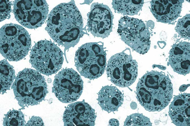 Intestinal Inflammation Diagnostics