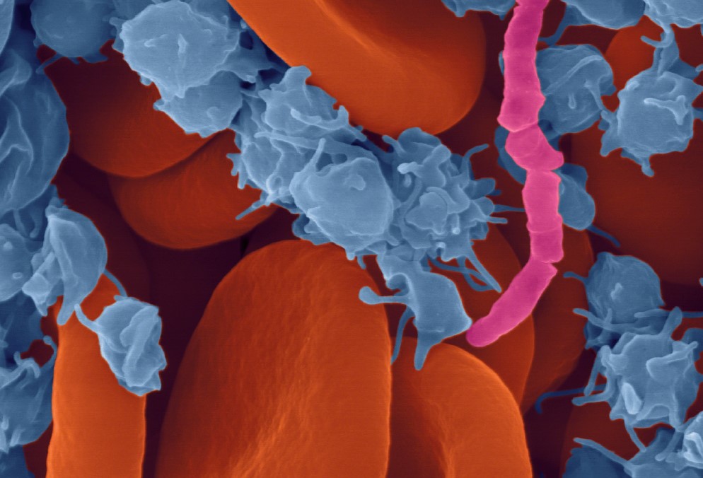 Positive Blood Culture Analysis