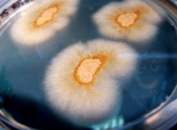 Filamentous Fungi Identification