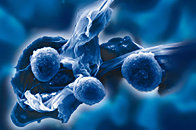 Entamoeba histolytica